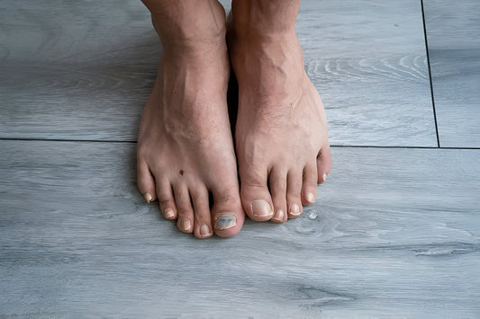 Iodine for Fungus Toenail