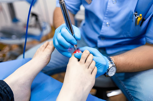 nail fungus treatment laser