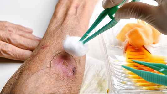 Povidone-Iodine in Antisepsis: State of the Art