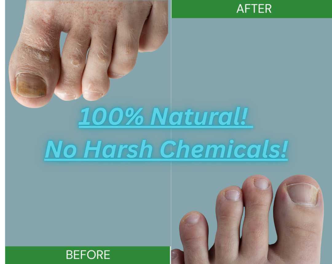 IodinePure EZ Clear Nails Toe Kit with Foot Tray