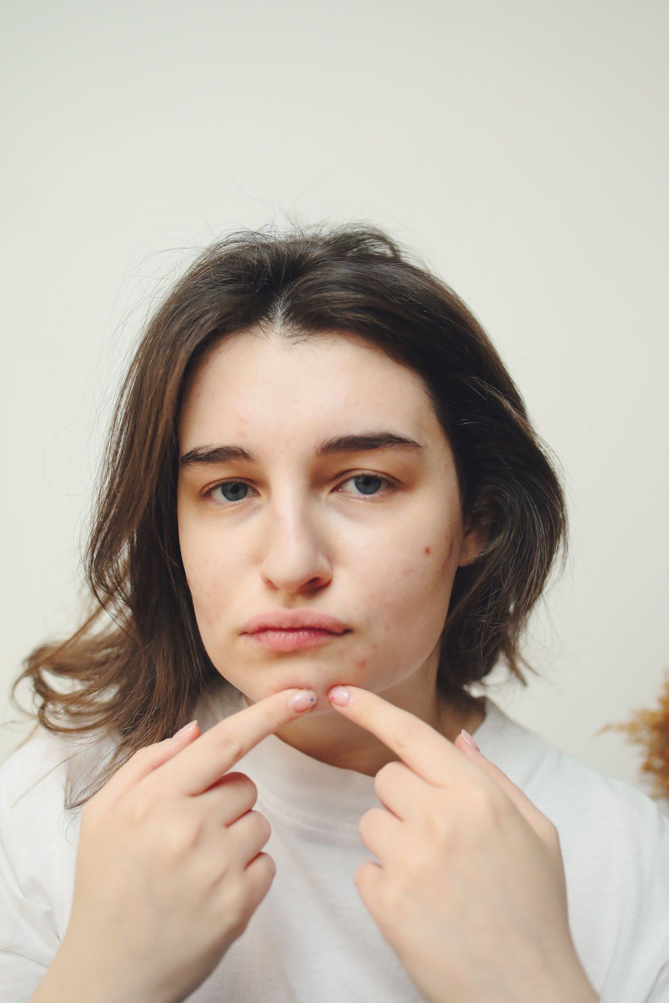“My skin keeps breaking out, and nothing gentle works.”