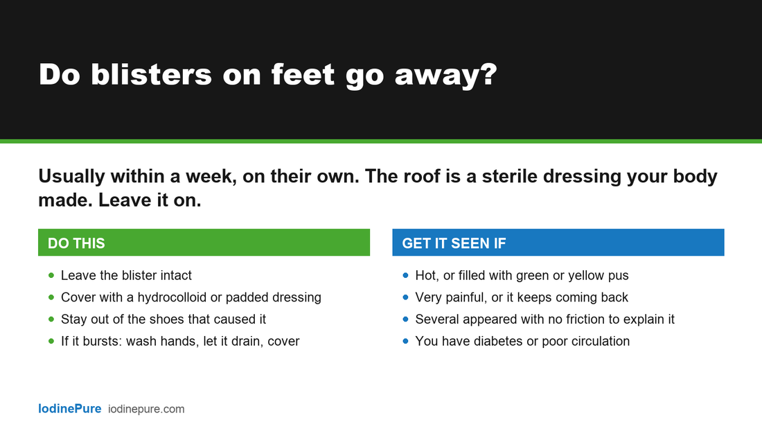 Answer card: do blisters on feet go away? Usually within a week. Leave the blister intact, cover it, stay out of the shoes that caused it. Get it seen if hot, full of pus or very painful.