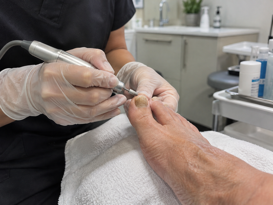 What to Put on Your Toenails After Debridement: The At-Home Aftercare Guide