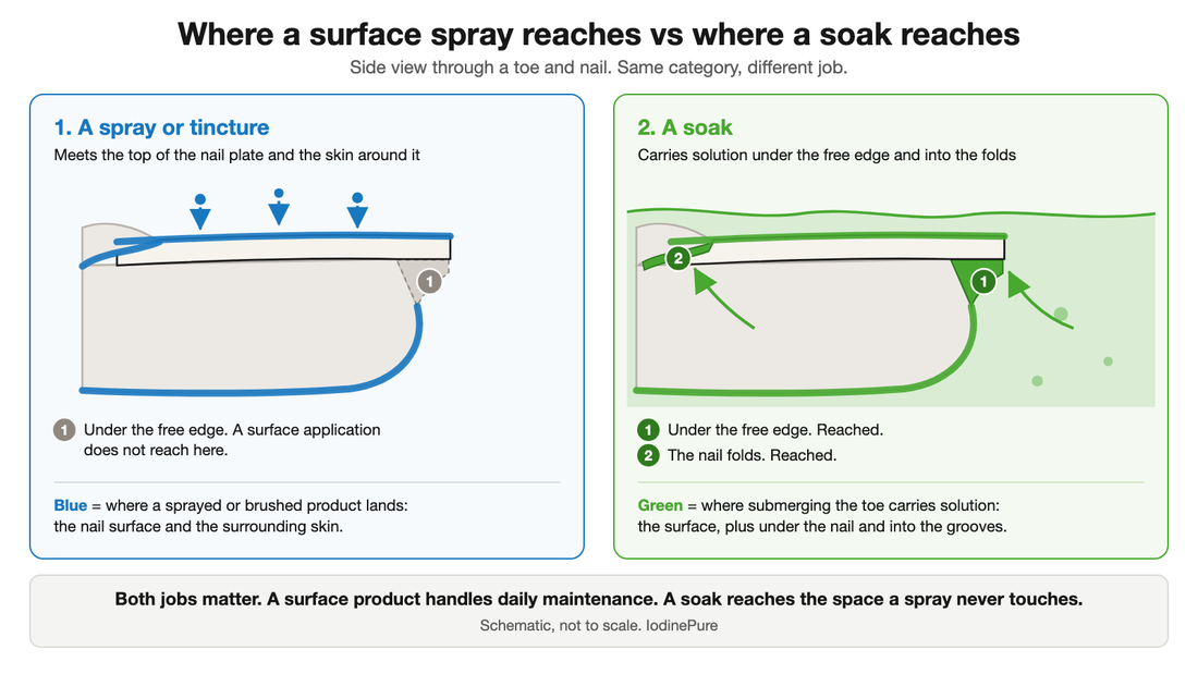 Cross-section diagram of a toe and nail. A spray or tincture reaches the top of the nail plate and the skin around it, but not under the free edge. A soak carries solution under the free edge and into the nail folds.