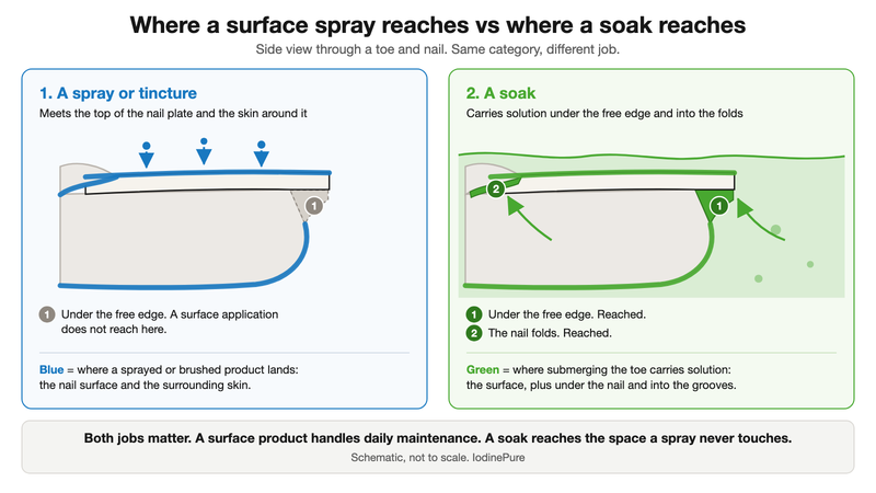 Cross-section diagram of a toe and nail. A spray or tincture reaches the top of the nail plate and the skin around it, but not under the free edge. A soak carries solution under the free edge and into the nail folds.