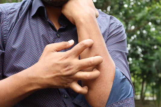 Person scratching itchy irritated skin, the discomfort jock itch home remedies aim to settle