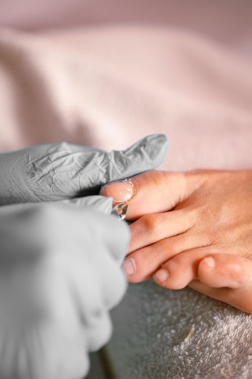 Foot pedicure spa care — yellow thick brittle toenails causes and clear nail recovery