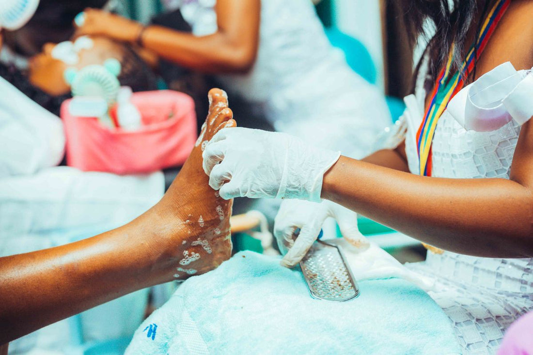 Foot care treatment in progress, the nail concern people reach for Emuaid ointment to address