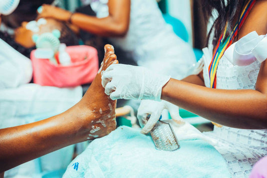 Foot care treatment in progress, the nail concern people reach for Emuaid ointment to address