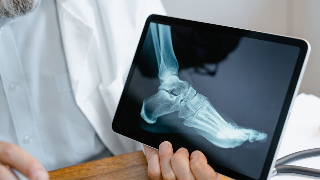 A clinician reviewing a foot X-ray on a tablet