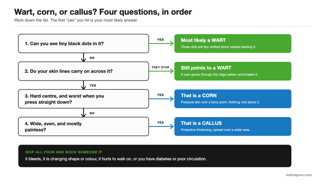 Four-question flowchart for telling a plantar wart, a corn and a callus apart on the foot.