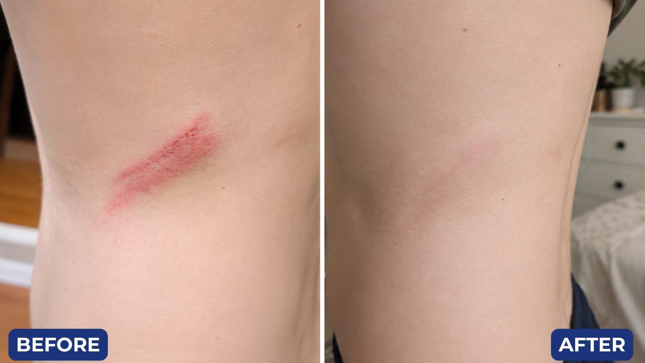 Before and after, scratch