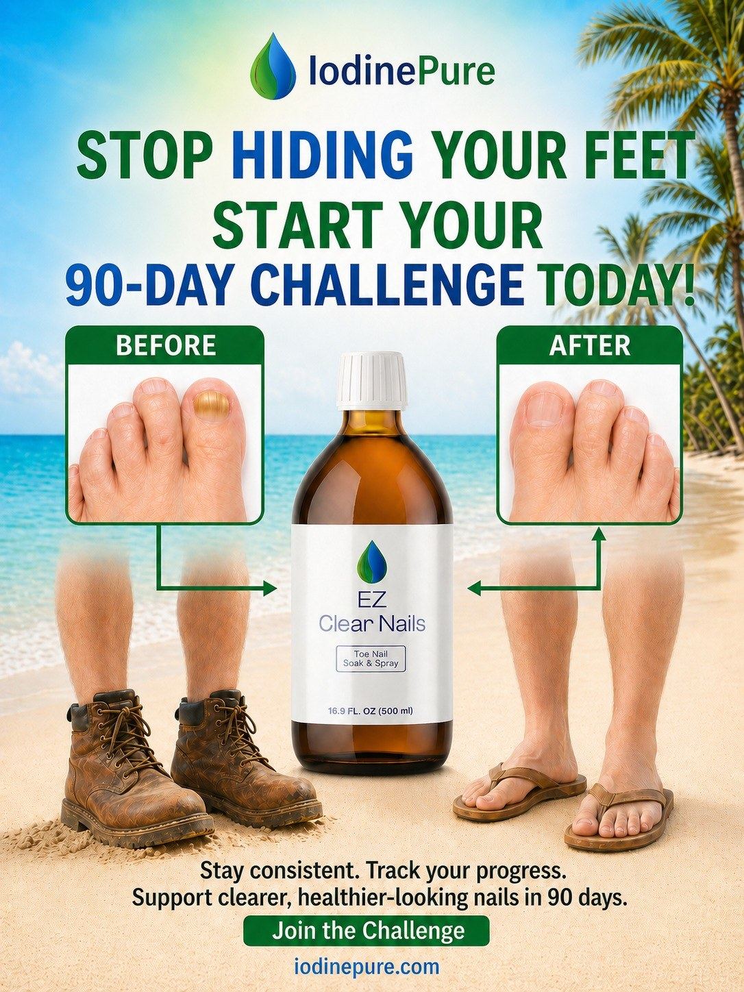 Stop hiding your feet, start your 90-Day Challenge today