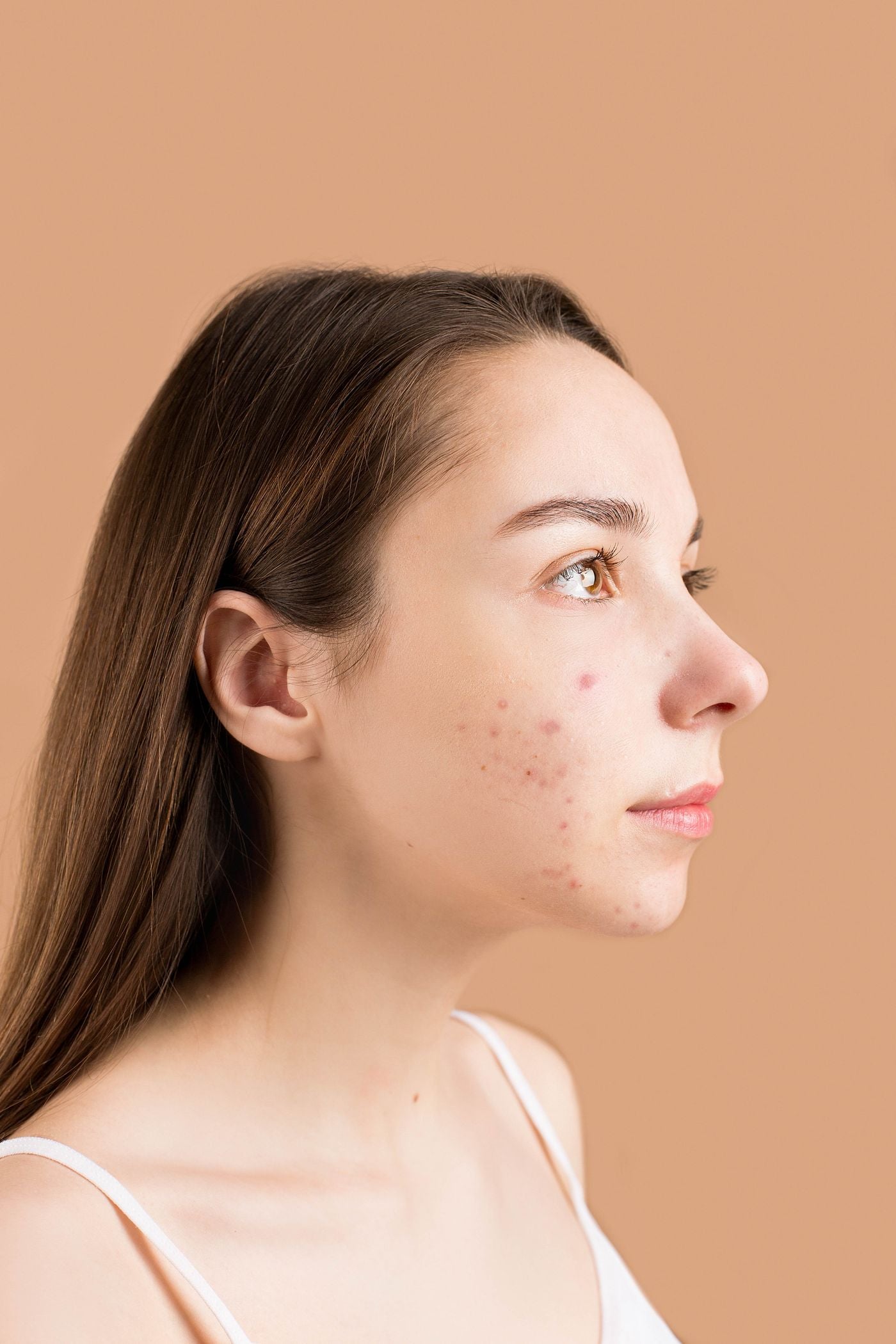 When your skin fights everything you try
